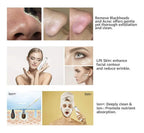 Limpiador ultrasónico exfoliante facial